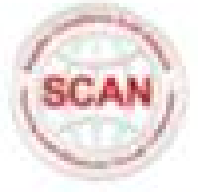 SCAN